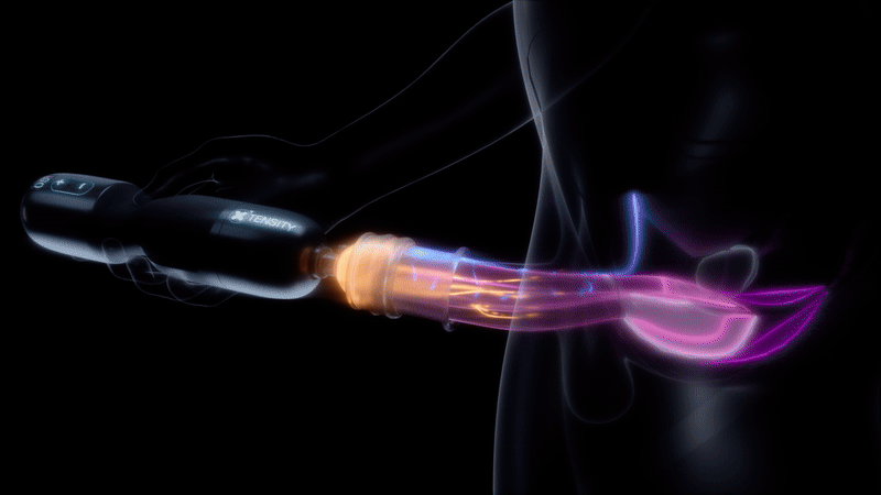 Xtensity Push Pull Technologie